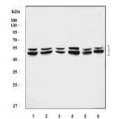 Western blot testing of 1) human HeLa, 2) human HepG2, 3) human Jurkat, 4) human T-47D, 5) rat L6 and 6) mouse C2C12 lysate with ATG4A antibody. Predicted molecular weight ~45 kDa, commonly observed between 45-60 kDa.