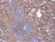 Immunohistochemistry of CD70 antibody in FFPE mouse spleen tissue. Mouse spleen demonstrates membranous and cytoplasmic HRP-DAB brown staining in activated lymphoid cells within splenic follicles and periarteriolar lymphoid regions, consistent with CD70 expression in activated T and B cell populations. This CD70 Antibody Rabbit Polyclonal was used following heat-induced epitope retrieval by boiling tissue sections in pH 8 EDTA buffer for 20 minutes and allowing sections to cool prior to staining.