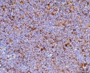 Immunohistochemistry of CD70 antibody in FFPE mouse lymph node tissue. Mouse lymph node shows scattered membranous and cytoplasmic HRP-DAB brown staining in activated lymphoid cells within cortical and paracortical regions, consistent with CD70 expression in subsets of activated T and B cells. This CD70 Antibody Rabbit Polyclonal was used following heat-induced epitope retrieval by boiling tissue sections in pH 8 EDTA buffer for 20 minutes and allowing sections to cool prior to staining.