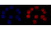 MSH2 Antibody Mouse Monoclonal 6B4F7. Immunofluorescence analysis of FFPE human Caco-2 cells shows strong nuclear staining corresponding to MutS homolog 2 (MSH2) protein localization. Red fluorescent signal highlights MSH2-positive nuclei throughout the cell population, while DAPI counterstain (blue) marks total nuclear DNA for reference. The staining pattern demonstrates clear nuclear accumulation consistent with the role of MSH2 as a DNA mismatch repair protein functioning within the nucleus. Heat-induced epitope retrieval was performed by steaming sections in pH6 citrate buffer for 20 minutes prior to antibody incubation.