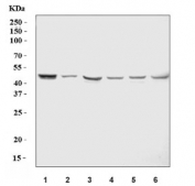 ZIC1 Antibody Multi-Species WB. Western blot analysis of human U-251, human SH-SY5Y, rat brain, rat C6, mouse brain, and mouse NIH 3T3 lysates using ZIC1 Antibody / Neural Development Transcription Factor Antibody demonstrates a consistent immunoreactive band at approximately 45-48 kDa across all samples tested. The observed molecular weight is consistent with the predicted size of Zinc Finger Protein of the Cerebellum 1 (ZIC1), a developmental transcription factor that regulates neurogenesis, neural patterning, cerebellar development, and cellular differentiation. Detection of a similarly sized band in human, rat, and mouse samples supports recognition of ZIC1 across multiple species and is consistent with the highly conserved nature of ZIC family transcription factors. The widespread expression observed in neural-derived tissues and cell lines aligns with the established role of ZIC1 in nervous system development and maintenance of developmental gene expression programs.