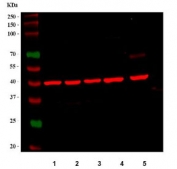Western blot testing of 1) human HepG2, 2) human HeLa, 3) human Jurkat, 4) human K562 and 5) mouse liver tissue lysate with ACAT2 antibody. Predicted molecular weight: ~41 kDa (isoform 1) and ~45 kDa (isoform 2).