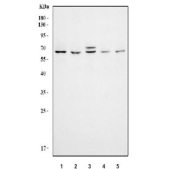 Western blot testing of huma 1) Jurkat, 2) CCRF-CEM, 3) 293T, 4) HeLa and 5) MCF7 cell lysate with KAT5 antibody. Predicted molecular weight ~59 kDa.