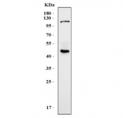 Western blot testing of human placental tissue lysate with KCa3.1 antibody. Predicted molecular weight ~48 kDa.