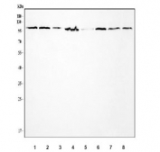PPP1R15A Antibody Multi-Cancer Human Cell and Rat Testis WB. Western blot analysis of PPP1R15A expression in multiple cell and tissue lysates. Lane 1: human K562. Lane 2: human HEL. Lane 3: human RT4. Lane 4: human U-251. Lane 5: human SiHa. Lane 6: human U-87 MG. Lane 7: human PC-3. Lane 8: rat testis tissue lysate. PPP1R15A antibody detects a prominent band at approximately 73 kDa across multiple samples, consistent with the predicted molecular weight of Protein Phosphatase 1 Regulatory Subunit 15A (GADD34). PPP1R15A may also migrate at up to approximately 110 kDa due to post-translational modification or altered electrophoretic mobility. This result demonstrates that the PPP1R15A Antibody / Protein Phosphatase 1 Regulatory Subunit 15A Antibody is suitable for detecting endogenous PPP1R15A by Western blot in human and rat samples.