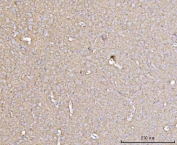 DBN1 Synaptic Plasticity Marker Antibody Rat Brain IHC. Immunohistochemistry analysis of FFPE rat brain tissue using DBN1 antibody (clone 4F6E7) shows diffuse cytoplasmic staining in neuronal cells with fine granular signal in the neuropil, consistent with DBN1 / Drebrin localization in dendritic processes and synaptic regions. The staining pattern highlights actin-rich compartments associated with dendritic spine structure and synaptic plasticity, while non-neuronal regions display comparatively lower signal. Hematoxylin counterstain provides nuclear contrast and tissue context. HIER: boil FFPE tissue sections in pH 8 EDTA for 20 min and allow to cool before testing.
