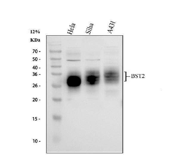 Tetherin Antibody / BST2 Antiviral Protein Antibody Cancer Cell Line WB. Western blot analysis of 1) human HeLa, 2) human SiHa, and 3) human A431 whole cell lysates using Tetherin Antibody / BST2 Antiviral Protein Antibody. Specific immunoreactive bands are detected at approximately 28-37 kDa, consistent with the heterogeneous glycosylation of BST2/Tetherin. Although the predicted molecular weight of the unglycosylated protein is approximately 20 kDa, glycosylated forms commonly migrate at higher apparent molecular weights in western blot analysis.