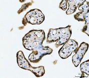 IHC staining of FFPE human placental tissue with MRE11 antibody. HIER: boil tissue sections in pH8 EDTA for 20 min and allow to cool before testing.