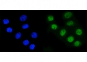 RAD21 Antibody Human Cancer Cell IF. Immunofluorescent staining of FFPE human SiHa cells using RAD21 Antibody (green) with DAPI nuclear counterstain (blue). HIER was performed by steaming sections in pH 6 citrate buffer for 20 minutes prior to staining. RAD21 Antibody, a Cohesin Complex Protein Antibody, demonstrates strong nuclear localization in SiHa cells, consistent with the role of RAD21 in the cohesin complex, chromosome organization, sister chromatid cohesion, and regulation of genome stability.