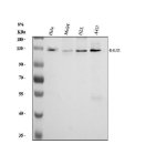 RAD21 Antibody Human Cell WB. Western blot analysis of human HeLa, MOLT4, HEL, and A431 cell lysates using RAD21 Antibody at 0.5 ug/ml. Lane 1: HeLa, Lane 2: MOLT4, Lane 3: HEL, Lane 4: A431. An HRP-conjugated secondary antibody with ECL substrate was used for detection. RAD21 Antibody, a Cohesin Complex Protein Antibody, detects a band at approximately 130 kDa, consistent with the reported migration pattern of RAD21. The observed molecular weight is higher than the predicted 72 kDa size and may reflect post-translational modification and altered SDS-PAGE migration of the cohesin complex protein.