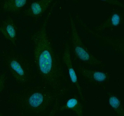 Immunofluorescent staining of FFPE human HeLa cells with STAT6 antibody (red) and DAPI nuclear stain (blue). HIER: steam section in pH6 citrate buffer for 20 min.