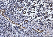 von Willebrand Factor Antibody / Hemostasis Research Antibody. Immunohistochemistry analysis of human tonsil tissue shows HRP-DAB brown staining of endothelial cells lining vascular channels within lymphoid tissue. The staining outlines elongated and branching vessel structures, with signal localized along the endothelial surface consistent with VWF presence at the vascular interface. This pattern reflects vessel-associated regions where VWF contributes to platelet adhesion and coagulation factor support in hemostatic processes. Endothelial-lined vessels are clearly distinguished from surrounding lymphoid cells and stromal components. HIER: boil tissue sections in pH8 EDTA for 20 min and allow to cool before testing.