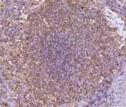 CD135 Antibody Spleen IHC. Immunohistochemistry analysis of FFPE human spleen tissue stained with CD135 antibody. Distinct membranous and cytoplasmic HRP-DAB brown staining is observed within lymphoid cell populations, consistent with the expected expression profile of Fms-like tyrosine kinase 3 / FLT3/CD135, a class III receptor tyrosine kinase involved in hematopoietic progenitor regulation, cytokine-responsive signaling, and immune-associated cellular development pathways. Tissue sections underwent HIER using pH 8 EDTA buffer prior to immunostaining.