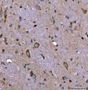 NEDD4 Antibody Brain IHC Rat Neuronal Cytoplasmic Staining. Immunohistochemistry analysis of Neural precursor cell expressed developmentally down-regulated protein 4 / NEDD4 in FFPE rat brain tissue using NEDD4 Antibody for IHC. HRP-DAB brown chromogenic staining demonstrates cytoplasmic localization within neuronal cell bodies distributed throughout the tissue, with surrounding neuropil showing lighter background signal. HIER: boil tissue sections in pH8 EDTA for 20 min and allow to cool before testing.