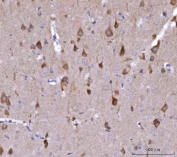 NEDD4 Antibody Rat Brain Tissue IHC Neuronal Distribution Pattern. Immunohistochemistry analysis of Neural precursor cell expressed developmentally down-regulated protein 4 / NEDD4 in FFPE rat brain tissue using NEDD4 Antibody for IHC. Brown HRP-DAB staining highlights scattered neuronal populations with distinct cell body labeling and minimal staining in non-neuronal regions, consistent with NEDD4 expression in neural tissue. HIER: boil tissue sections in pH8 EDTA for 20 min and allow to cool before testing.
