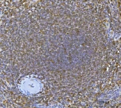 IRF7 Antibody Human Spleen IHC. Immunohistochemistry staining of FFPE human spleen tissue using IRF7 Antibody / Antiviral Response Protein Antibody demonstrates widespread nuclear and cytoplasmic HRP-DAB brown staining throughout splenic lymphoid cell populations. Strong immunoreactivity is observed within cells populating the white pulp, consistent with expression of Interferon Regulatory Factor 7 (IRF7), a transcription factor that serves as a master regulator of type I interferon production and antiviral immune responses. The staining pattern aligns with the established role of IRF7 in innate immune activation, host defense signaling, and regulation of interferon-dependent gene expression within lymphoid tissues. HIER: boil tissue sections in pH 8 EDTA for 20 minutes and allow to cool before testing.