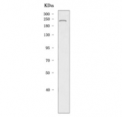 DNA methyltransferase 1 Antibody Mouse Testis WB. Western blot testing of mouse testis tissue lysate with DNA methyltransferase 1 antibody. Predicted molecular weight: 180-200 kDa.