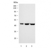Western blot testing of human 1) SW620, 2) Caco-2 and 3) DLD1 cell lysate with CDX2 antibody. Predicted molecular weight: 33-40 kDa.