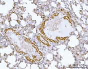 HBEGF Antibody Mouse Lung IHC. Immunohistochemistry analysis of FFPE mouse lung tissue stained with HBEGF antibody detecting Heparin-binding EGF-like growth factor (DT-R). Epithelial cells lining airway and alveolar structures show membranous and cytoplasmic staining, consistent with localization of HBEGF as a cell surface receptor capable of mediating diphtheria toxin binding and receptor-mediated internalization, as well as EGFR ligand signaling. Surrounding stromal regions show comparatively lower signal. Hematoxylin counterstain highlights nuclei in blue. HIER: boil tissue sections in pH 8 EDTA for 20 min and allow to cool before testing.