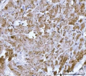 HBEGF Antibody Rat Respiratory Smooth Muscle IHC. Immunohistochemistry analysis of FFPE rat respiratory smooth muscle tissue stained with HBEGF antibody detecting Heparin-binding EGF-like growth factor (DT-R). Smooth muscle cells show cytoplasmic and membranous staining, consistent with expression of HBEGF as a membrane-associated precursor that can function as a diphtheria toxin receptor and EGFR ligand. Surrounding connective tissue shows comparatively reduced signal. Hematoxylin counterstain highlights nuclei in blue. HIER: boil tissue sections in pH 8 EDTA for 20 min and allow to cool before testing.
