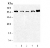 ACACA Antibody for WB. Western blot analysis of ACACA / Acetyl-CoA carboxylase 1 expression in multiple species lysates using ACACA Antibody for WB. Lane 1: human HeLa cell lysate, Lane 2: human A549 cell lysate, Lane 3: rat brain lysate, Lane 4: mouse brain lysate, Lane 5: mouse NIH 3T3 cell lysate. A band is detected at approximately 260 kDa, consistent with the predicted molecular weight of Acetyl-CoA carboxylase 1 (ACACA). This high molecular weight band reflects the full-length cytosolic enzyme, which is known to undergo regulatory phosphorylation and may exhibit minor mobility variation depending on metabolic state.