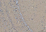 IHC staining of FFPE mouse brain tissue with EAAT1 antibody. HIER: boil tissue sections in pH8 EDTA for 20 min and allow to cool before testing.