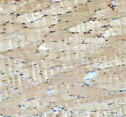 Immunohistochemical staining of FFPE human skeletal muscle tissue with ACSS2 antibody, HRP-secondary and DAB substrate. HIER: boil tissue sections in pH8 EDTA for 20 min and allow to cool before testing.