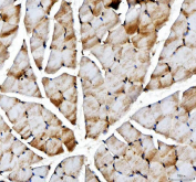 Immunohistochemical staining of FFPE rat skeletal muscle tissue with ACSS2 antibody, HRP-secondary and DAB substrate. HIER: boil tissue sections in pH8 EDTA for 20 min and allow to cool before testing.