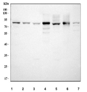 Western blot testing of 1) human HepG2, 2) human U-87 MG, 3) human MCF7, 4) rat liver, 6) rat C6, 7) mouse liver and 8) mouse Neuro-2a cell lysate with ACSS2 antibody. Predicted molecular weight ~79 kDa.