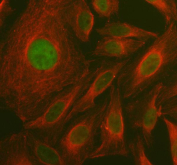 Immunofluorescent staining of FFPE human U-2 OS cells with MAT1A antibody (green) and Alpha Tubulin mAb (red). HIER: steam section in pH6 citrate buffer for 20 min.