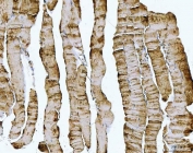 DOCK4 Antibody Human Skeletal Muscle IHC. Immunohistochemistry staining of FFPE human skeletal muscle using DOCK4 antibody demonstrates widespread cytoplasmic staining throughout skeletal muscle fibers, consistent with expression of Dedicator of Cytokinesis 4 (DOCK4). DOCK4 is a cell migration protein that regulates Rac-family GTPase signaling pathways involved in cytoskeletal organization, cellular adhesion, and maintenance of tissue architecture. The observed staining pattern within mature muscle fibers is consistent with the role of DOCK4 in coordinating cytoskeletal dynamics and cellular organization. These findings support the utility of DOCK4 antibody for studies of cell migration, cytoskeletal regulation, and tissue morphogenesis pathways. HIER: boil tissue sections in pH8 EDTA for 20 min and allow to cool before testing.