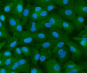 INF2 Antibody A549 Cell IF. Immunofluorescent staining of FFPE human A549 cells with INF2 Antibody (green) and DAPI nuclear counterstain (blue). HIER was performed by steaming tissue sections in pH 6 citrate buffer for 20 minutes prior to staining. INF2 Antibody / Actin Regulation Protein Antibody demonstrates cytoplasmic staining consistent with Inverted Formin 2 expression and supports studies of actin cytoskeleton remodeling, cellular structure regulation and intracellular organization pathways.
