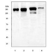 INF2 Antibody Human, Mouse and Rat WB. Western blot testing of human HeLa, human A549, rat C6 and mouse brain tissue lysates with INF2 Antibody. Lane 1: human HeLa; Lane 2: human A549; Lane 3: rat C6; Lane 4: mouse brain. Predicted molecular weight: ~136 kDa, with INF2 routinely observed at 170â180 kDa. INF2 Antibody / Actin Regulation Protein Antibody detects endogenous Inverted Formin 2 expression and supports studies of actin cytoskeleton remodeling, organelle dynamics, intracellular organization and cell structure regulation pathways.