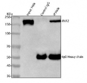 INF2 Antibody Human HeLa Cell IP. Immunoprecipitation of INF2 protein from 500 ug of human HeLa whole cell lysate using 2 ug of INF2 Antibody. Immunoprecipitated protein was analyzed by Western blot, with input lysate and control IgG samples included for comparison. INF2 Antibody / Actin Regulation Protein Antibody successfully enriches endogenous Inverted Formin 2 protein and supports studies of actin cytoskeleton remodeling, protein interactions, organelle dynamics and intracellular structural regulation pathways.