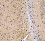 INF2 Antibody Mouse Brain IHC. Immunohistochemistry staining of FFPE mouse brain tissue with INF2 Antibody at 2 ug/ml. HIER was performed using pH 8 EDTA buffer, followed by blocking with 10% goat serum. The tissue section was incubated with rabbit anti-INF2 antibody overnight at 4Â°C, followed by HRP-conjugated goat anti-rabbit IgG secondary antibody and DAB chromogen detection. INF2 Antibody / Actin Regulation Protein Antibody demonstrates cytoplasmic staining consistent with Inverted Formin 2 expression and supports studies of actin cytoskeleton remodeling, neuronal cell structure and intracellular organization pathways.