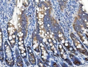 IHC staining of FFPE rat colon tissue with TFG antibody. HIER: boil tissue sections in pH8 EDTA for 20 min and allow to cool before testing.