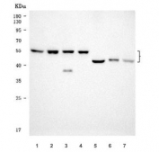 SERBP1 Antibody Human Mouse Rat WB. Western blot testing of 1) human LNCaP, 2) human K562, 3) human Daudi, 4) human HEL, 5) rat kidney, 6) mouse skeletal muscle and 7) mouse kidney tissue lysate with SERBP1 antibody. Predicted molecular weight ~45 kDa but observed at 45-60 kDa.