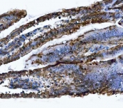 VAPA Antibody Mouse Colon IHC. Immunohistochemistry staining of FFPE mouse colon tissue using VAPA Antibody / ER Membrane Contact Site Protein demonstrates moderate to strong HRP-DAB brown staining within colonic epithelial cells lining the mucosal crypt structures. The observed staining pattern is predominantly membranous and cytoplasmic, consistent with expression of Vesicle-Associated Membrane Protein-Associated Protein A (VAPA), an endoplasmic reticulum-associated protein involved in membrane contact site formation, intracellular trafficking, lipid transport, and organelle communication. Staining highlights epithelial architecture throughout the colonic mucosa and supports evaluation of VAPA expression and localization in mouse gastrointestinal tissue. Heat-induced epitope retrieval was performed by boiling tissue sections in pH 8 EDTA buffer for 20 minutes followed by cooling prior to staining.