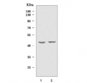 Western blot testing of human 1) Caco-2 and 2) A549 cell lysate with TIMD4 antibody. Predicted molecular weight ~42 kDa.