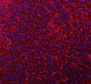 Immunofluorescent staining of FFPE mouse liver tissue with Timd2 antibody (red) and DAPI nuclear stain (blue). HIER: steam section in pH8 EDTA buffer for 20 min.