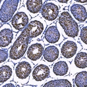 IHC staining of FFPE rat testis tissue with SAE1 antibody. HIER: boil tissue sections in pH8 EDTA for 20 min and allow to cool before testing.