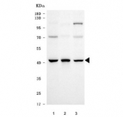 Western blot testing of human 1) HepG2, 2) Daudi and 3) HEL cell lysate with MRPP1 antibody. Predicted molecular weight ~47 kDa, commonly observed at 40-47 kDa.