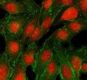 Immunofluorescence analysis of TRMT5 expression. TRMT5 antibody (red) and Alpha Tubulin antibody (green) staining was performed on immunocytochemical sections of human U2OS cells, with nuclear counterstaining using DAPI (blue). TRMT5 signal is observed in both nuclear and cytoplasmic compartments, consistent with reported TRMT5 localization, while Alpha Tubulin highlights the microtubule network. Cells were blocked with goat serum and incubated with rabbit anti-TRMT5 antibody and mouse anti-Alpha Tubulin antibody overnight at 4 degrees C, followed by Cy3-conjugated goat anti-rabbit IgG and DyLight 488-conjugated goat anti-mouse IgG secondary antibodies, and images were acquired using a fluorescence microscope with appropriate filter sets.