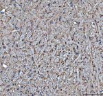 Hsp90 beta Antibody Mouse Brain IHC. Immunohistochemistry analysis of FFPE mouse brain tissue using Hsp90 beta Antibody. Heat induced antigen retrieval was performed in pH 8.0 EDTA buffer prior to overnight incubation with primary antibody (2 ug/mL) at 4Â°C. Peroxidase-conjugated goat anti-mouse IgG and DAB chromogen were used for visualization. Predominantly cytoplasmic staining is observed throughout neuronal cell populations, consistent with the constitutive expression of HSP90AB1 as a molecular chaperone involved in protein folding and cellular stress responses. These results support the use of Hsp90 beta Antibody for studying HSP90AB1, molecular chaperone function and nervous system biology.