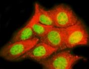 TRPS1 Antibody for IF / Tricho-Rhino-Phalangeal Syndrome Type I IF Antibody. Immunofluorescence analysis in human MCF7 cells. FFPE human MCF7 cells stained with TRPS1 Antibody for IF show strong nuclear fluorescence (green), consistent with TRPS1 localization as a transcription factor. Co-staining with Alpha Tubulin monoclonal antibody (red) highlights the cytoskeletal network, providing clear contrast for subcellular localization. Antigen retrieval was performed using pH6 citrate buffer with heat-induced epitope retrieval prior to staining, supporting high-resolution fluorescence imaging of TRPS1 distribution within epithelial cancer cells.