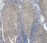 SMARCB1 Antibody by IHC Showing Tonsil Tissue Distribution Immunohistochemistry of FFPE human tonsil sections using SMARCB1 Antibody at 2 ug/ml. Widespread nuclear staining is evident throughout the tissue, with the lower-magnification view demonstrating the distribution of SMARCB1/INI1-positive cells across the tonsillar architecture. This INI1 Polyclonal Antibody was tested following heat-induced epitope retrieval in EDTA buffer.