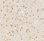 SMARCB1 Antibody by IHC in Human Cerebral Cortex Immunohistochemistry of FFPE human cerebral cortex sections using SMARCB1 Antibody at 2 ug/ml. Strong nuclear labeling is visible in numerous neurons, while the surrounding neuropil shows comparatively weaker staining. The prominent neuronal nuclear signal is consistent with the expected localization of SMARCB1/INI1. This INI1 Polyclonal Antibody was tested following heat-induced epitope retrieval in EDTA buffer.