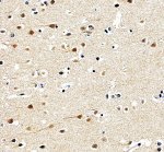 SMARCB1 Antibody by IHC in Cortical Neurons Immunohistochemistry of FFPE human cerebral cortex sections using SMARCB1 Antibody at 2 ug/ml. Numerous neurons exhibit distinct nuclear staining, with variation in signal intensity among individual cells. The staining demonstrates nuclear localization of SMARCB1/INI1 within cortical neurons. This INI1 Polyclonal Antibody was tested following heat-induced epitope retrieval in EDTA buffer.