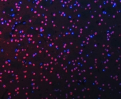 Immunofluorescent staining of FFPE mouse brain tissue with RNA-binding protein 22 antibody (red) and DAPI nuclear stain (blue). HIER: steam section in pH8 EDTA buffer for 20 min.