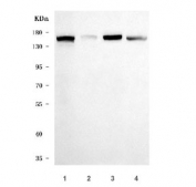 Desmoglein 2 Antibody Multi-Cell Line WB. Western blot analysis of human cell lysates using DSG2 antibody detecting Desmoglein 2. Lane 1: HeLa, Lane 2: K562, Lane 3: HepG2, Lane 4: A549. A band is detected at approximately 130-160 kDa, consistent with the predicted molecular weight of Desmoglein 2, with variation reflecting glycosylation of this transmembrane desmosomal cadherin. Stronger signal in epithelial-derived cell lines such as HeLa, HepG2, and A549 aligns with DSG2 expression in cells forming desmosomal adhesion complexes that support intercellular junction integrity.